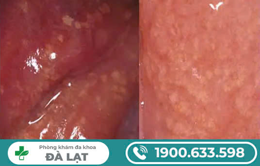 Hình ảnh minh họa